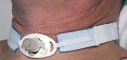 AirLife® Tracheostomy Tube Holder